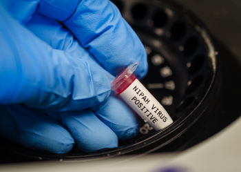 Nipah Vaccine
