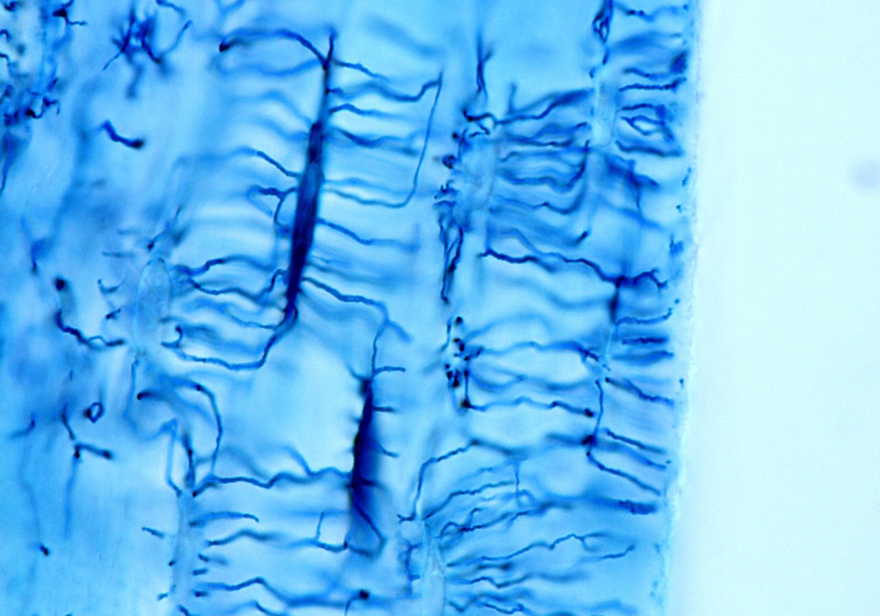 bone cells suppress cancer metastases