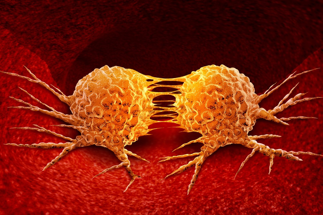 Dividing cancer cell metastasis division as a disease anatomy concept as a growing malignant tumor on an organ inside the human body as a 3D illustration.