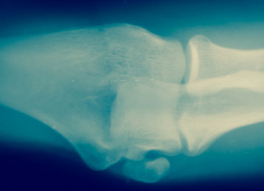 x-ray image of a bone