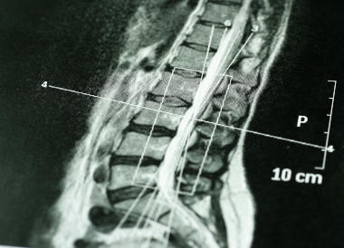 scan of a spine