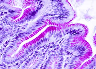 Gastric mucosa where the intense PAS positivity of the epithelium lining the inner surface of the stomach and the gastric pits is observed.