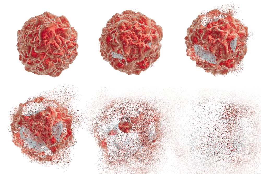 Series of images showing different stages of destruction of a tumor cell. 3D illustration. Can be used to illustrate effect of drugs, medicines, microbes, nanoparticles