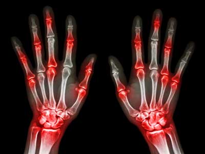 Division of Rheumatology