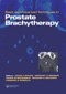 Prostate Brachytherapy