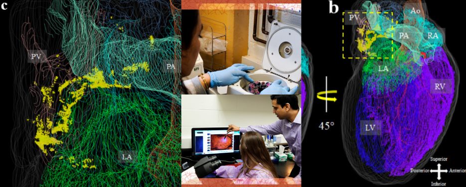 Models of the heart’s nervous system