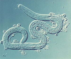 Onchocerca volvulus, a tiny parasitic worm
