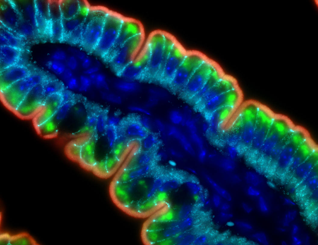 gut villus cross-section stained against GUCY2C antigen