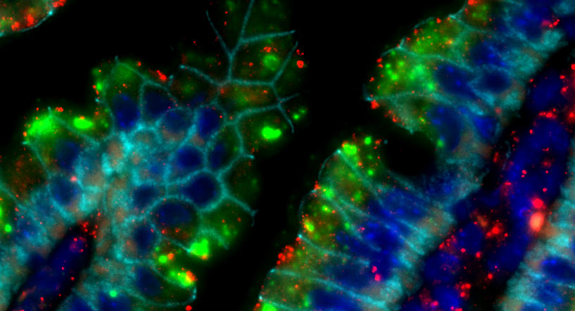 Gut villi stain for colon cancer vaccine